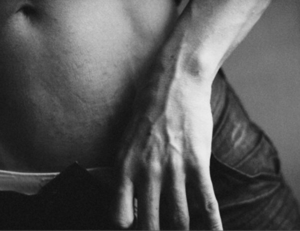 ¿Qué es la elefantiasis genital?