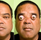 ¿Se pueden salir los ojos de las órbitas?