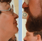 ¿Cómo se mide la intensidad de un olor?