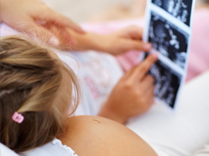 Los fetos también bostezan