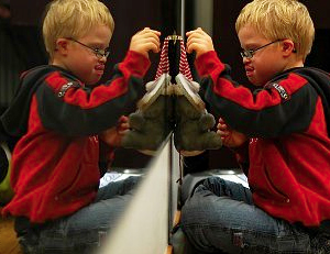 Un nuevo camino para silenciar el síndrome de Down