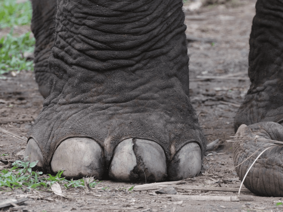 Linfedema: El problema que te hace tener pies de elefante