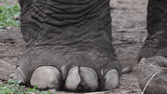 Linfedema: El problema que te hace tener pies de elefante