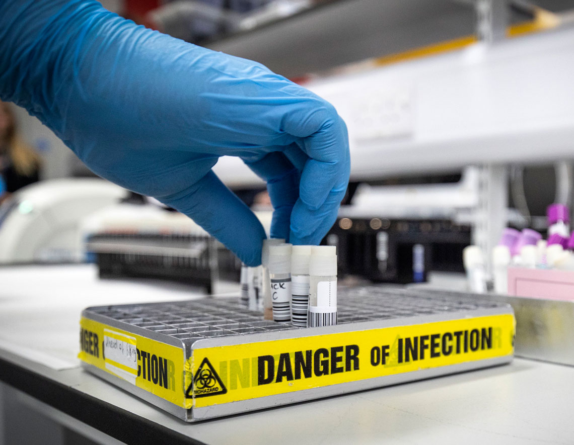 Muestra del nuevo coronavirus