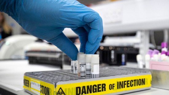 Muestra del nuevo coronavirus