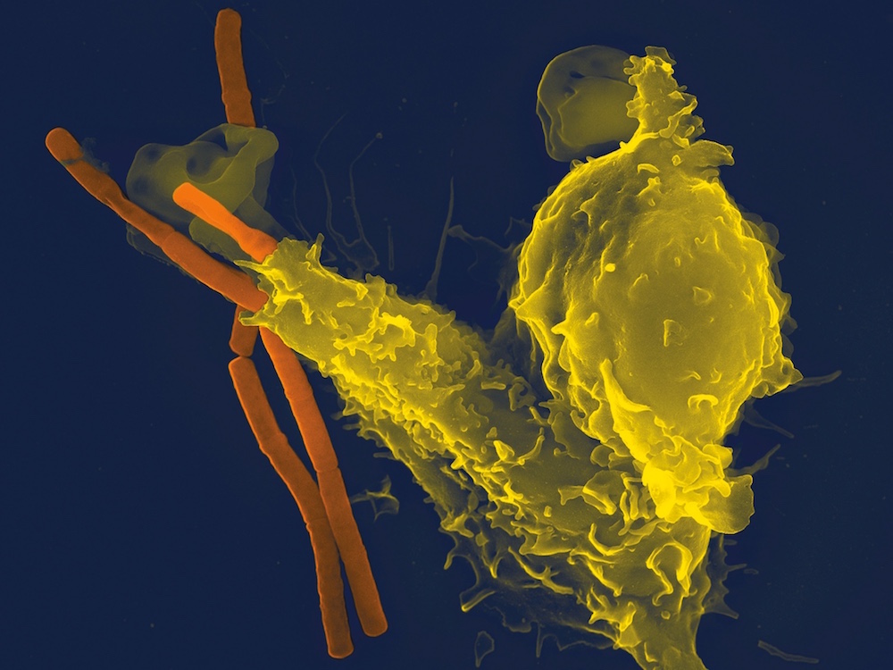 Así combaten las bacterias nuestro sistema inmune