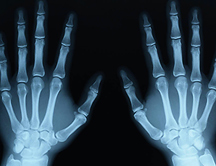 9 innovadoras aplicaciones de los rayos X