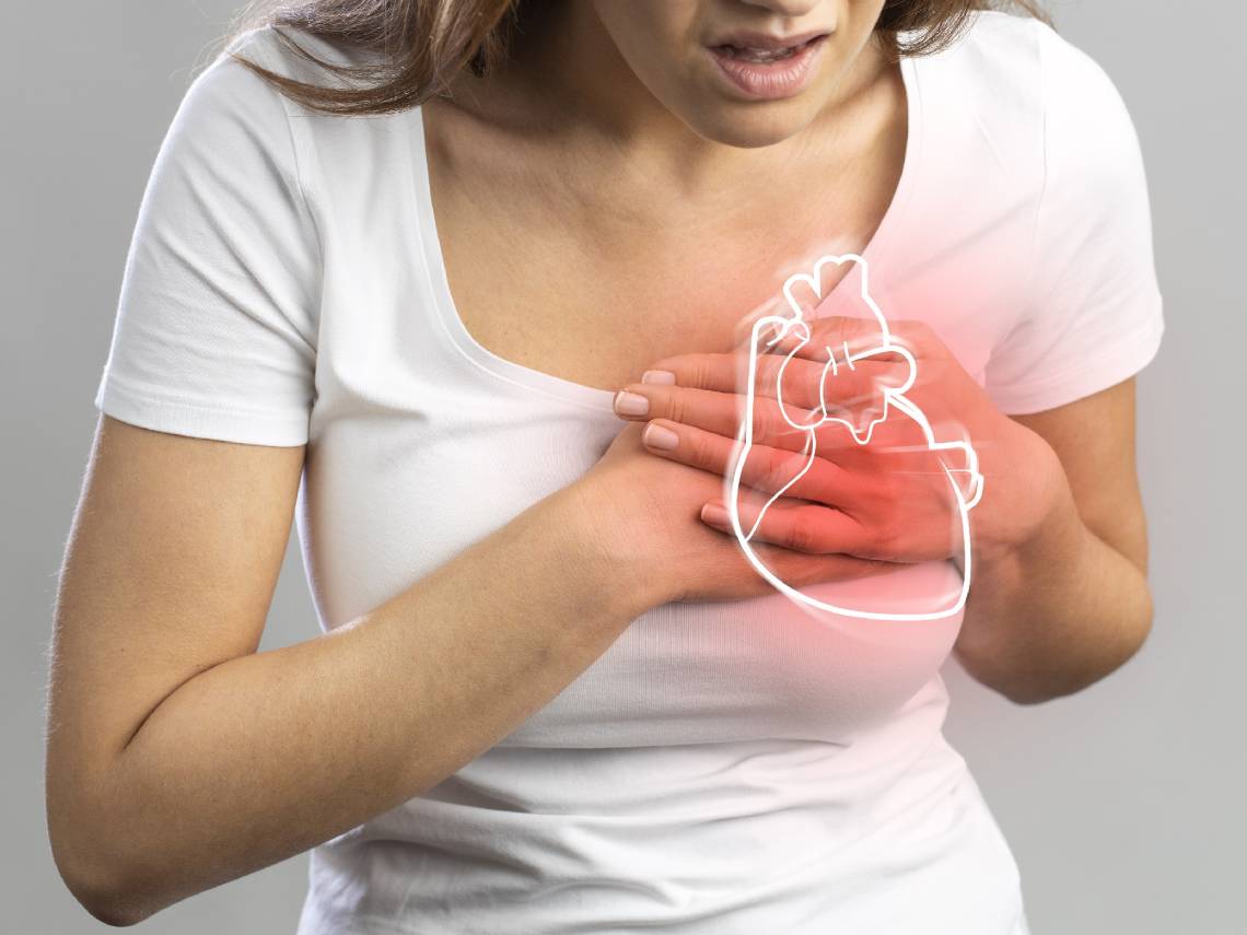 Mujer sufriendo un infarto