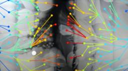 Evolución de bacterias