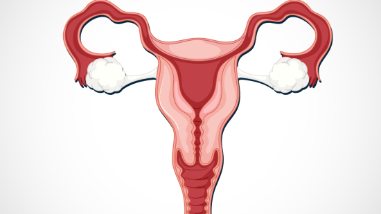 No es lo mismo tener quistes ováricos que síndrome de ovario poliquístico (SOP)