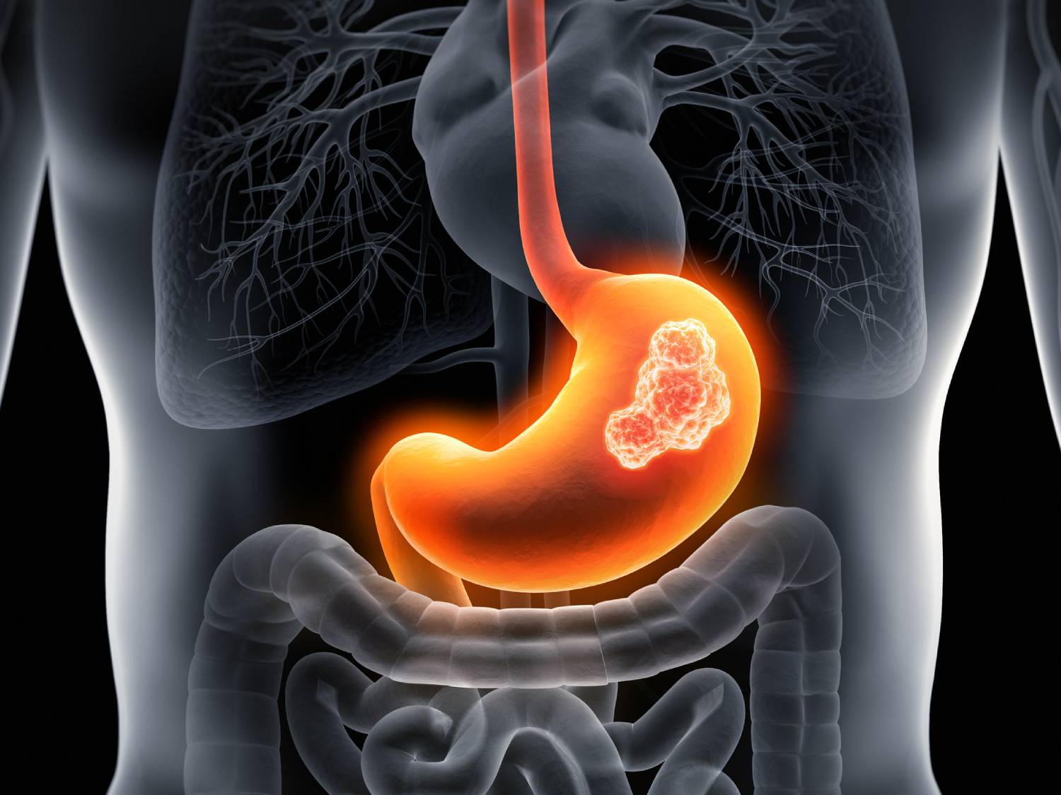 Infografía. Estómago