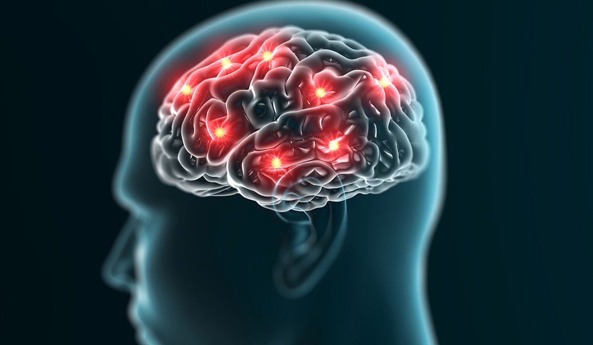 cerebro-inconsciente