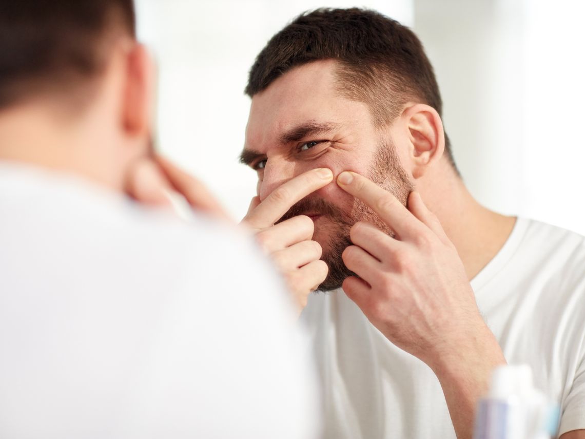 Hombre quitándose granos de la barba