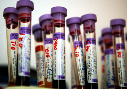 ¿Cuántos grupos sanguíneos existen realmente?