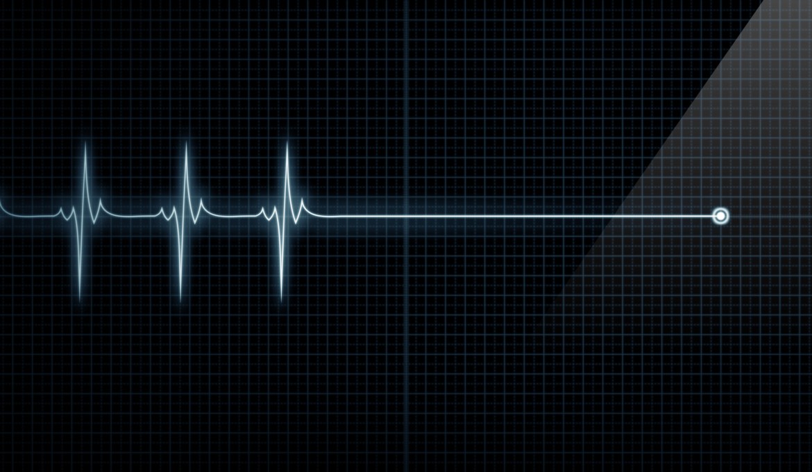 cerebro-antes-de-morir