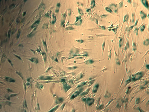 La 'jubilación' se contagia entre células