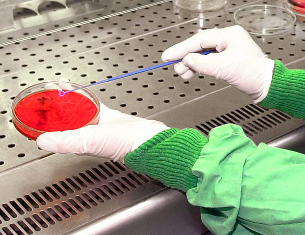 Las placas petri, el gran invento de la microbiología