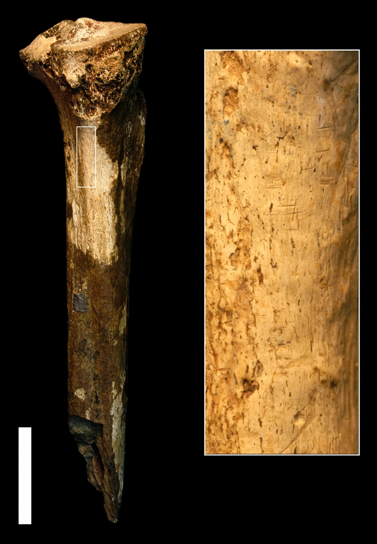 Tibia