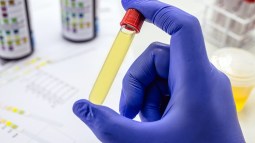 El secreto del color amarillo de la orina: cómo el cuerpo se deshace de las toxinas y los pigmentos