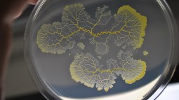 Blob en medio de cultivo