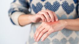 La alergia a los metales, un problema de salud cada vez más frecuente en España