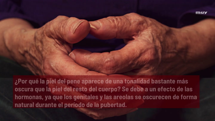 Por Qué  La Piel Del Pene Es Más Oscura