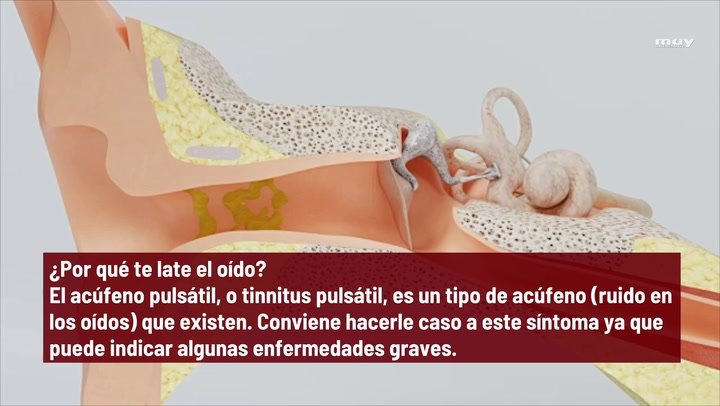 Por Qué  Te Late El Oído