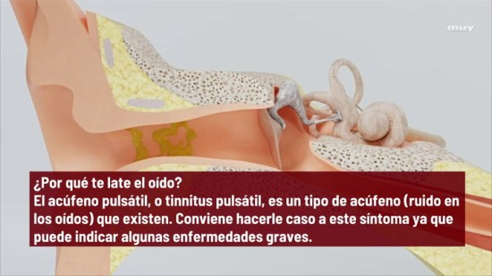 Por Qué  Te Late El Oído