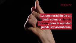 ¿Puede regenerarse un dedo? (Eugenio M. Fernández Aguilar)
