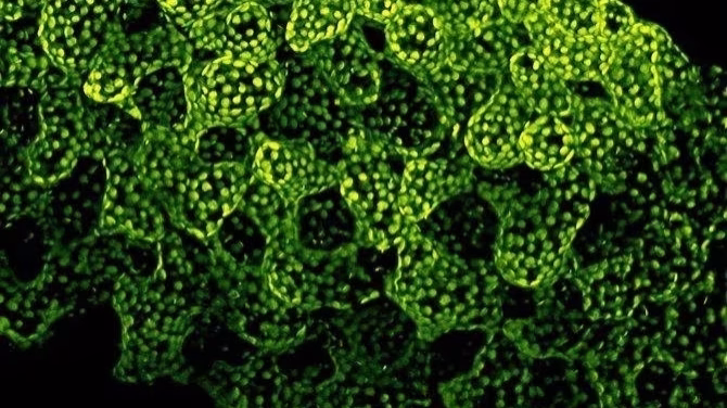 El asombroso experimento que recrea cómo pudo haber surgido la vida multicelular hace más de mil millones de años