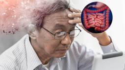 Inflamación intestinal y Alzheimer