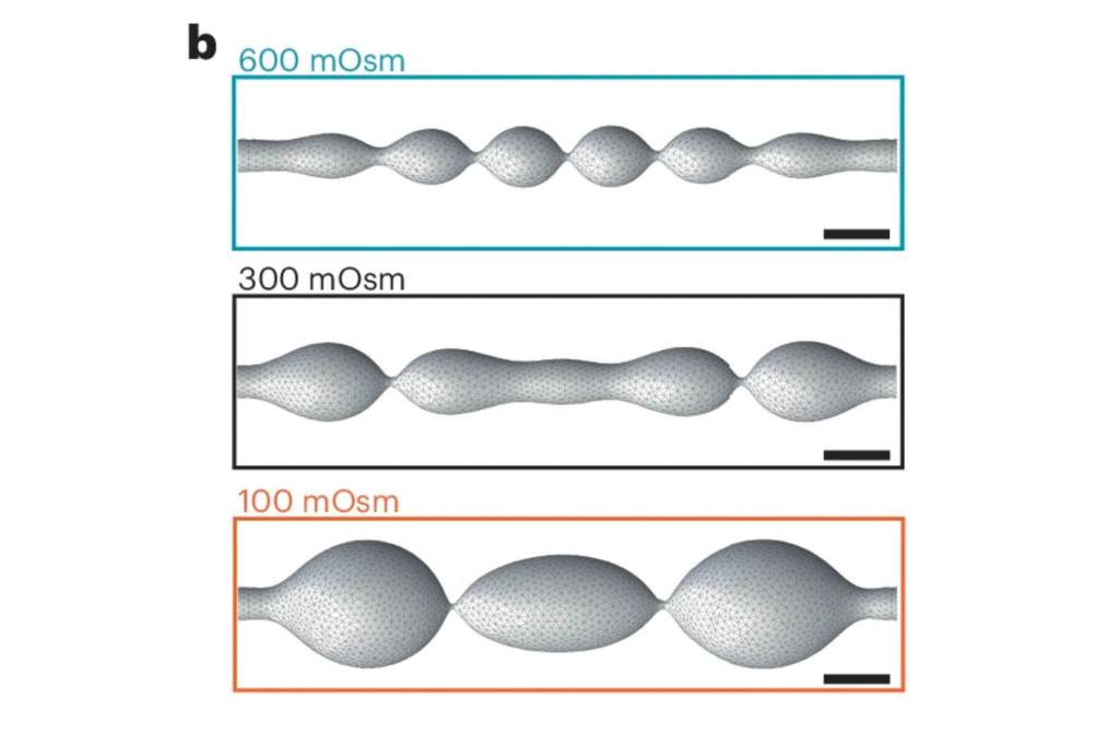 Axones con la forma de collar de perlas