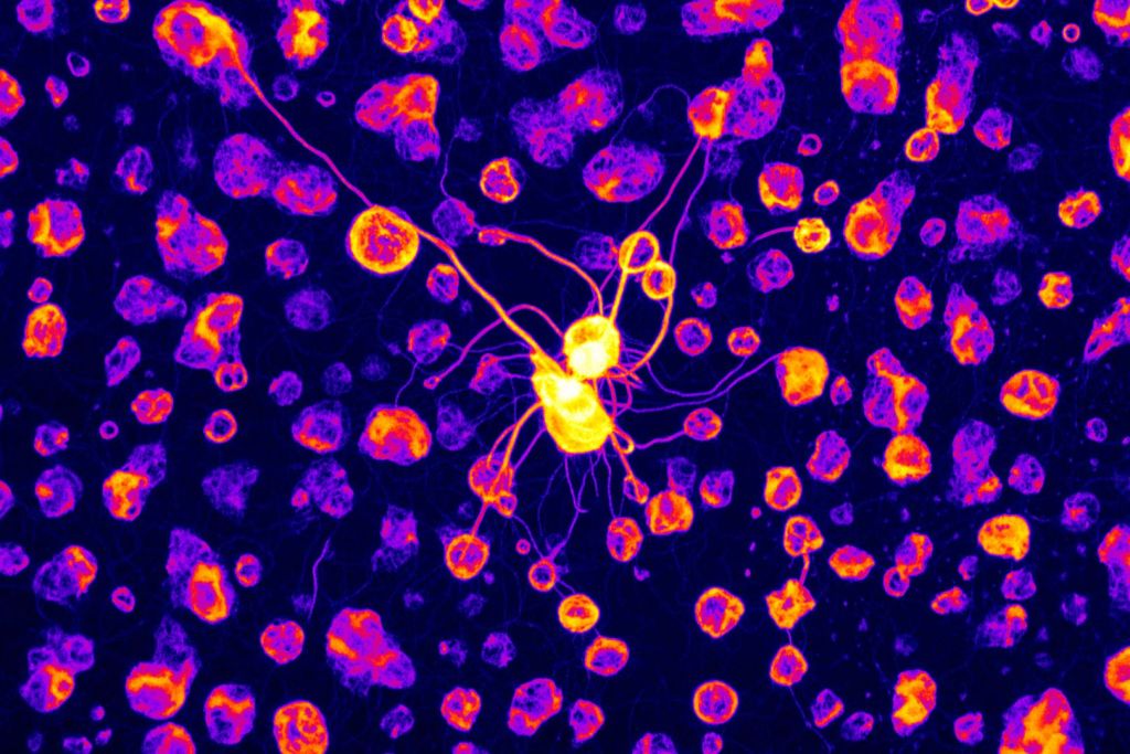 Agregados sólidos de CPEB4