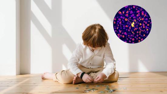 Nuevo estudio sobre el autismo