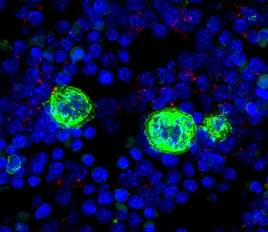 fragmentación de los megacariocitos
