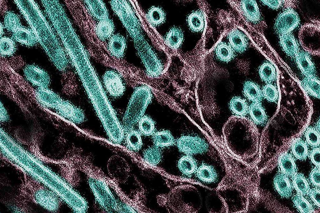 Micrografía electrónica de transmisión coloreada de partículas del virus H5N1