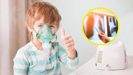 Prueban nuevo tratamiento inhalable para la fibrosis quística