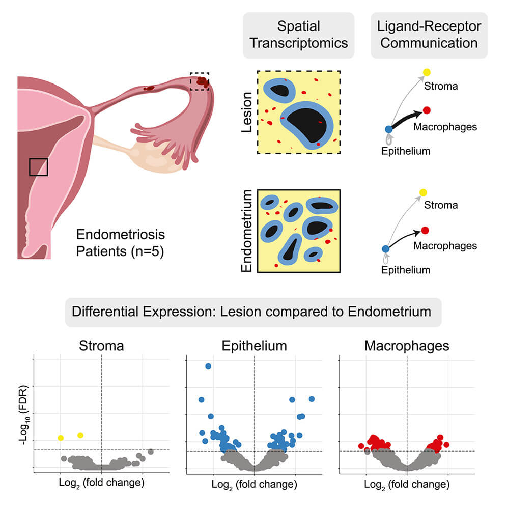 Gráfico del estudio inflamación endometria, tratamientos no hormonales