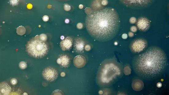 Diversidad de microorganismos presentes en una de las muestras de suelo analizadas en el proyecto MicroMundo.