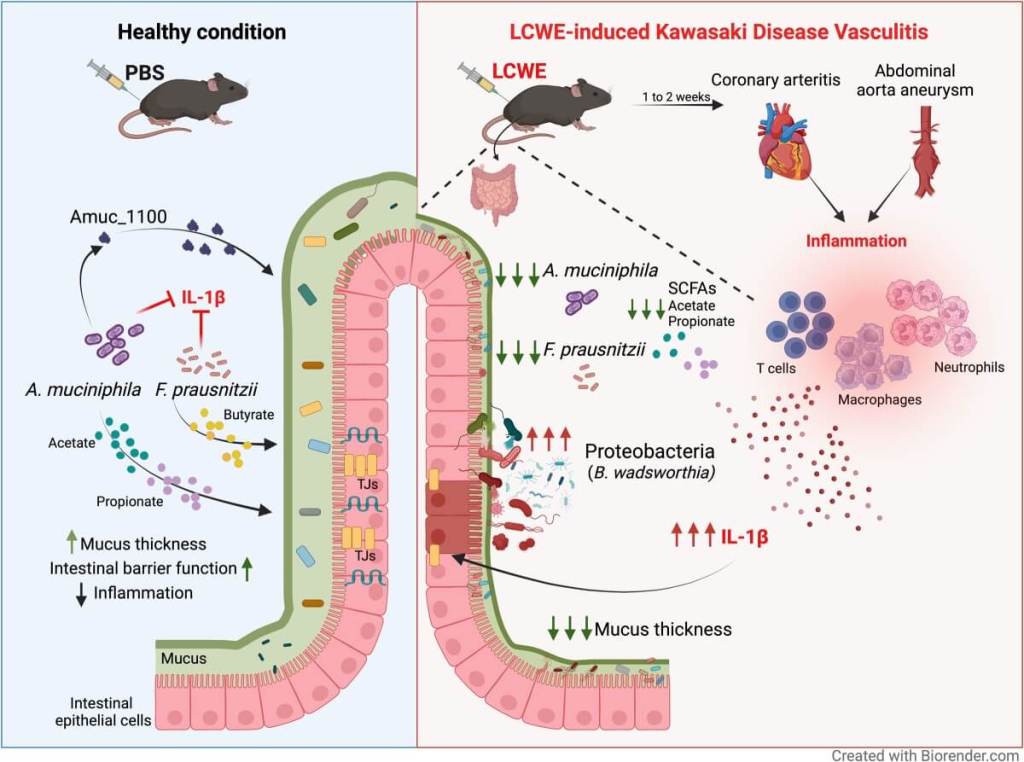 Un desequilibrio en la microbiota intestinal podría desencadenar inflamación cardiovascular y vasculitis, según estudio experimental