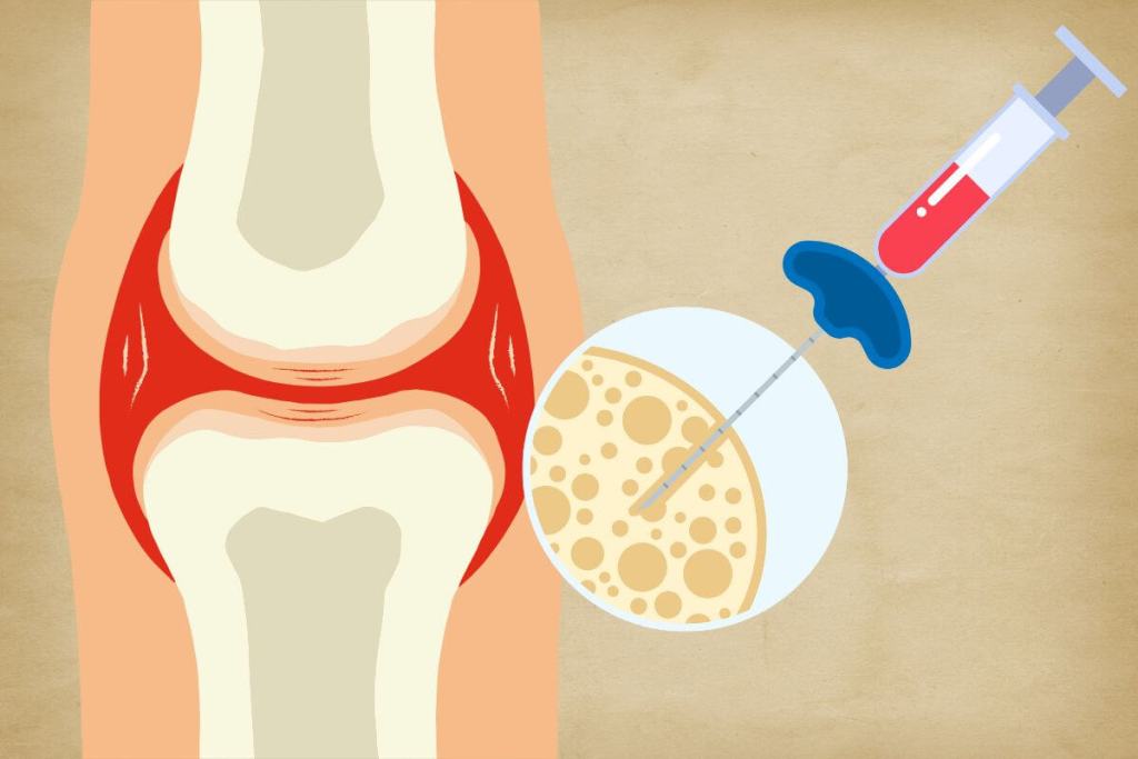 Una nueva técnica de imagen permite estudiar la médula ósea sin alterarla y podría transformar la investigación hematológica