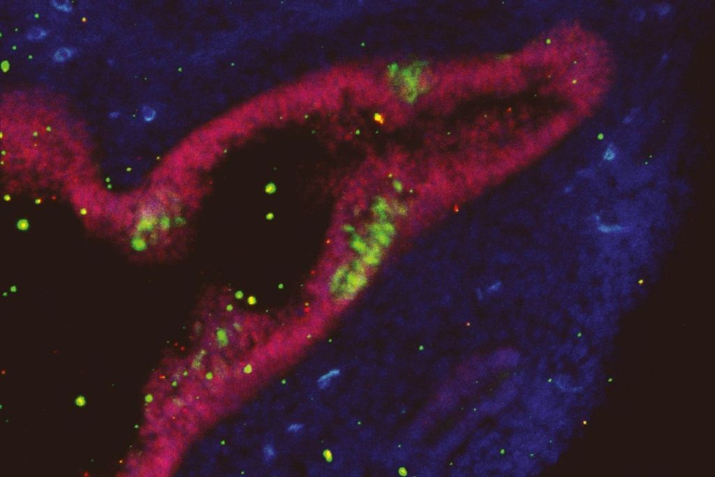 En los pulmones de ratones jóvenes y adultos, las células madre neurales periféricas (pNSCs) se localizan a lo largo de los conductos bronquiales. Estas células se identifican por la expresión del marcador Sox1 y, además, muestran simultáneamente la presencia de Sox2