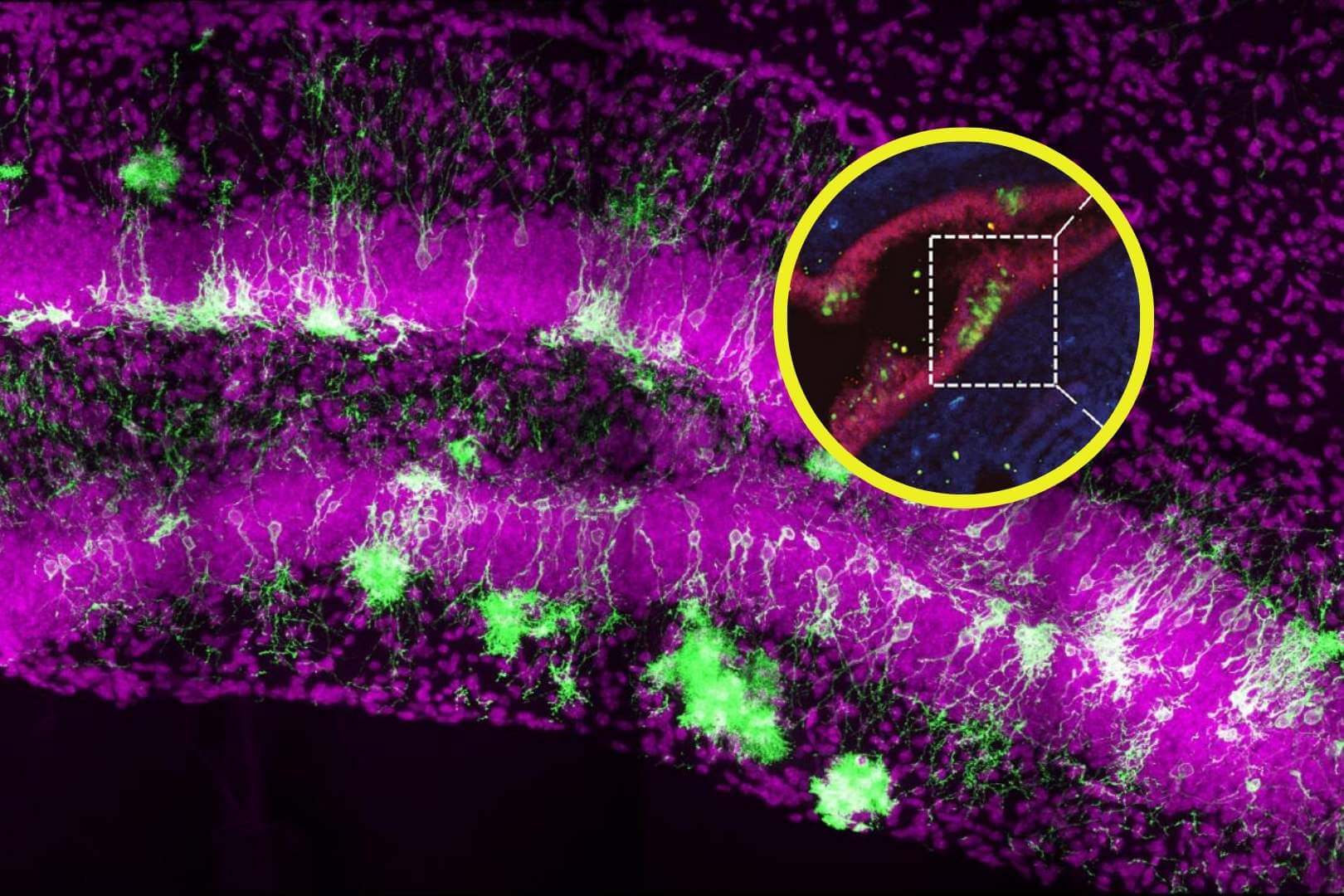 Un error de laboratorio lleva al hallazgo de células madre neurales fuera del cerebro