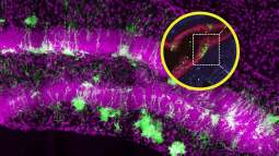 Un error de laboratorio lleva al hallazgo de células madre neurales fuera del cerebro