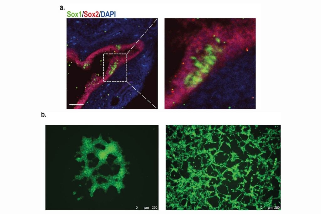 Los investigadores detectaron estas células distribuidas a lo largo de los bronquios en pulmones de ratones tanto recién nacidos como adultos
