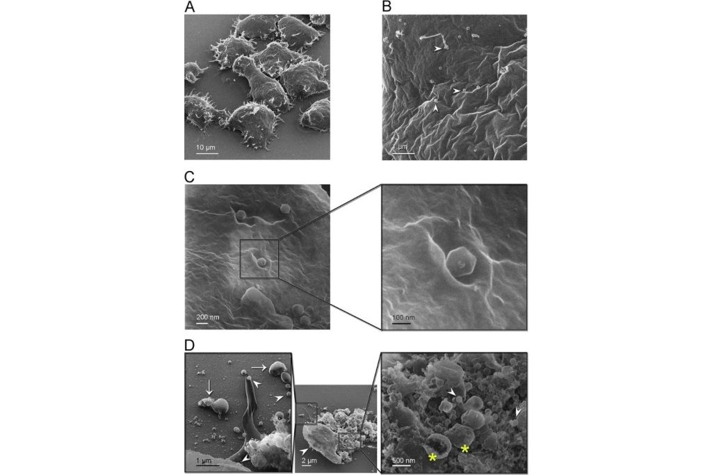 Imágenes obtenidas por microscopía de iones de helio muestran cómo el Jyvaskylavirus se adhiere a las células de A. castellanii