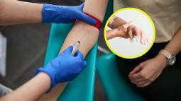 Un test de sangre sencillo permitiría detectar el Parkinson en sus fases más tempranas