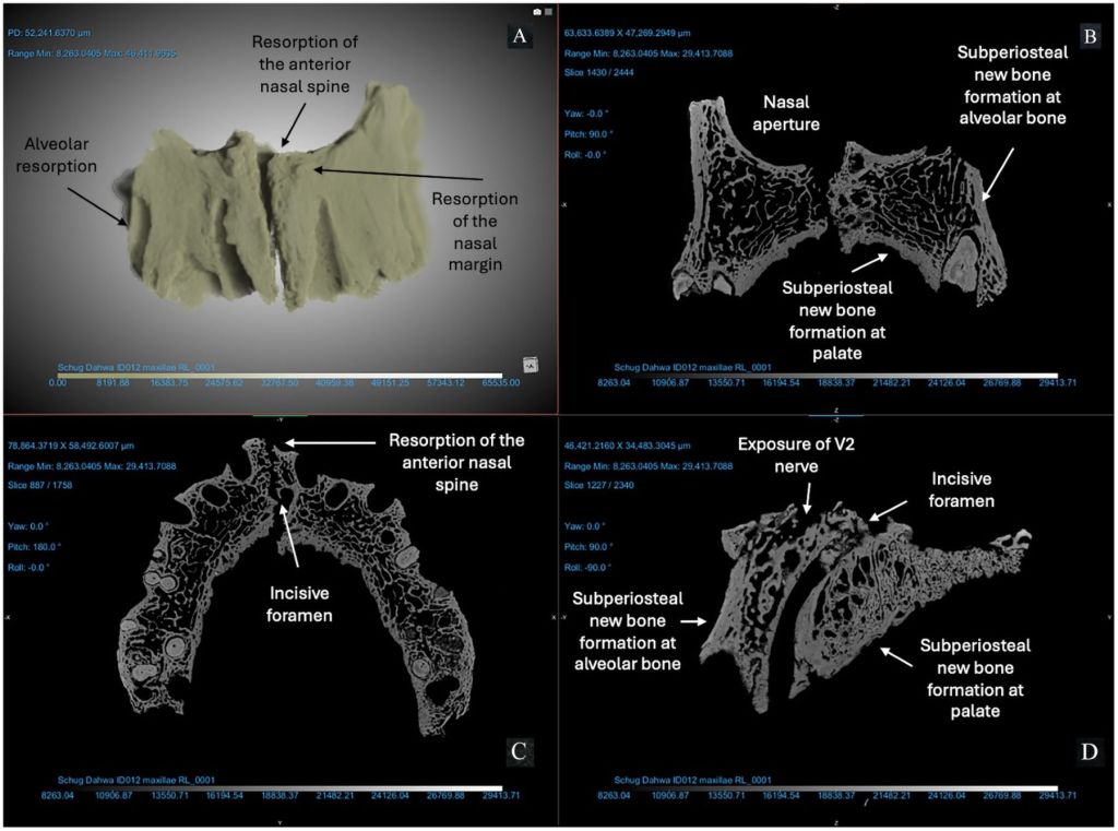 Escaneo micro-CT ID 012 maxilares