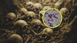 Lepra en la Edad del bronce