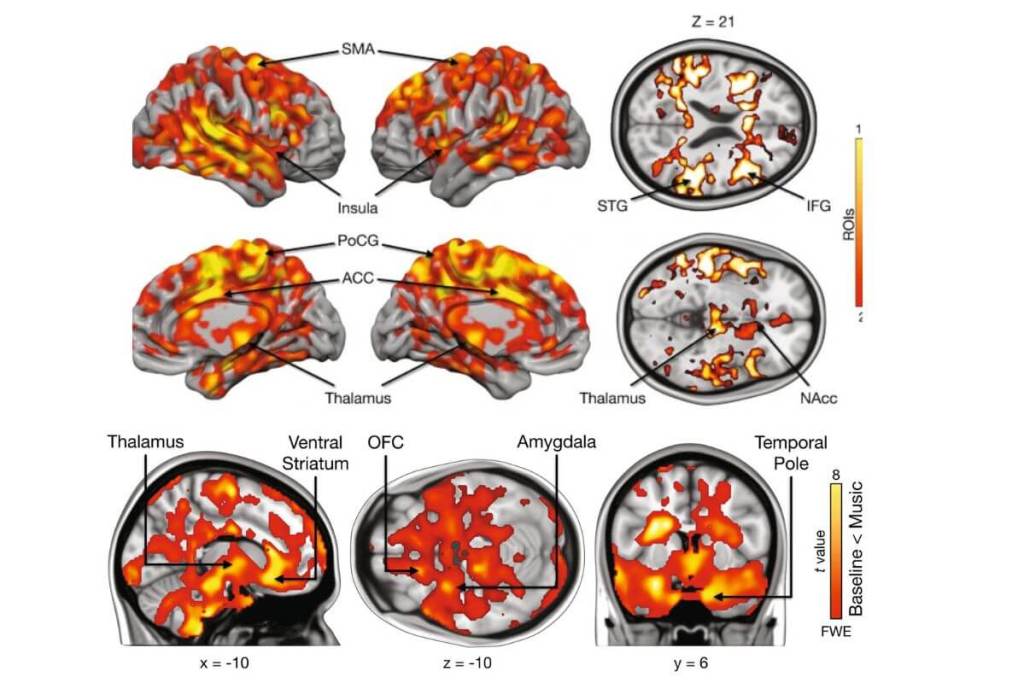 Gráfico del estudio